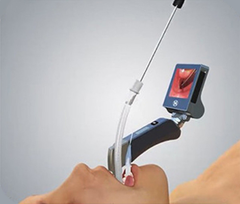 3 inci Full View CMOS Rigid Video Laryngoscope Dengan 5 Ukuran Pisau yang Dapat Digunakan Kembali