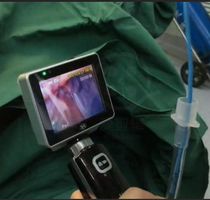 ICU EMS Single Use Intubasi Video Laringoskop Dengan Resolusi Kamera 1280 X 720