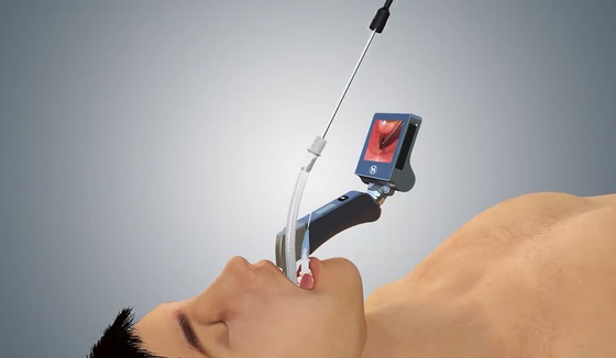 Departemen anestesiologi portabel Haiye Video Laryngoscope 1060 Hpa