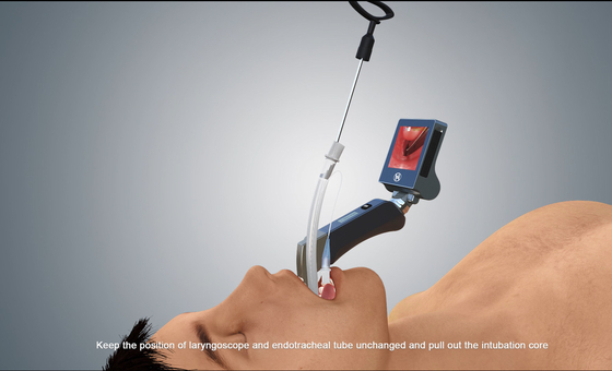 HYHJ-KC Tahan Air Medis Bedah Video Laryngoscope Sumber Cahaya LED