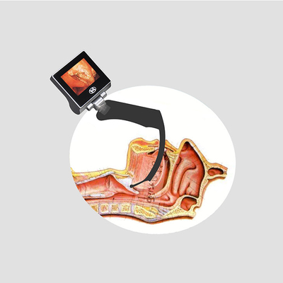 CMOS Intubasi Video Genggam Laryngoscope Dengan 70 Derajat Hyperangulated Glottis Visualization