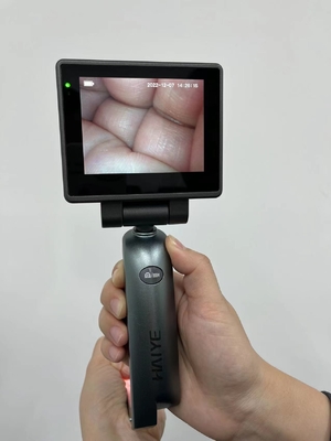 3,0 Inch HD Display Laryngoscope Video Medis - Laringoskop Video Intubasi