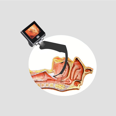 Resolusi Tinggi Portable Handheld Reuable Video Laryngoscope USB 32GB