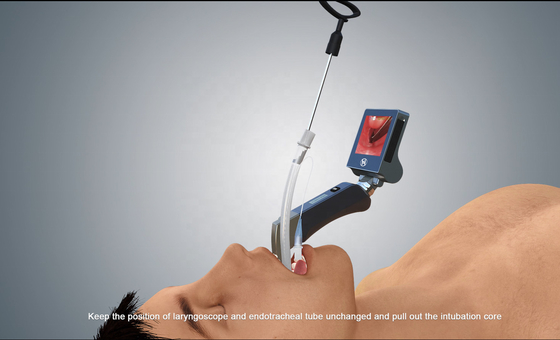 3 Inci LCD Intubasi Video Sekali Pakai Laryngoscope 1280*720 Px