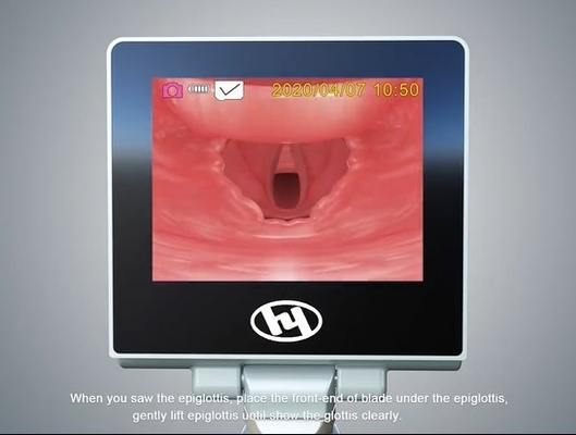 Reusable Anesthesia Video Laryngoscope Airway Intubation Dengan Tampilan yang Ditingkatkan