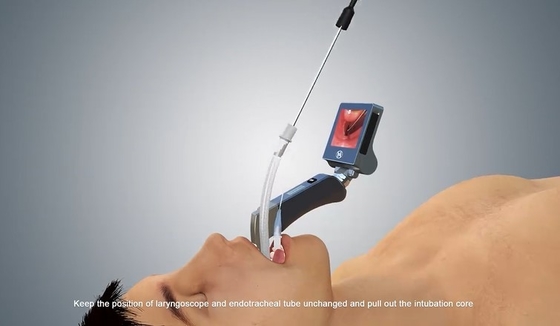 Laryngoscope Video Blade Isi Ulang yang Dapat Digunakan Kembali Untuk Intubasi Anestesi Medis